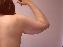 Body Contouring After Major Weight Loss Picture