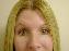 Botulinum Toxin Picture