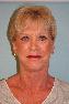 Facelift Picture