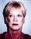 Facelift Picture