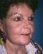 Facelift Picture