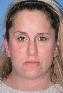 Eyelid Surgery Picture