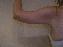 Arm Lift Picture