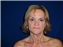 Facelift Picture
