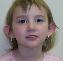 Ear Surgery Picture