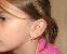 Ear Surgery Picture