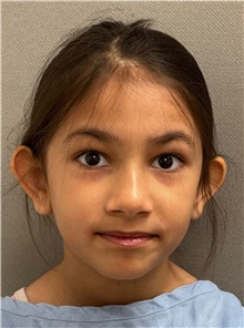 Ear Surgery Before Photo by Keshav Magge, MD; ,  - Case 50289