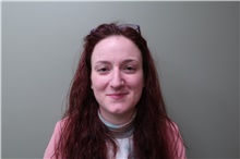 Rhinoplasty Before Photo by Badar Jan, MD; Allentown, PA - Case 44677