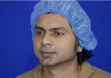 Chin Augmentation Before Photo by Thanapoom Boonipat, MD; Lubbock, TX - Case 51426