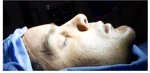 Chin Augmentation After Photo by Thanapoom Boonipat, MD; Lubbock, TX - Case 51426