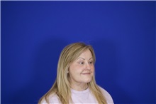 Eyelid Surgery After Photo by Thanapoom Boonipat, MD; Lubbock, TX - Case 51531