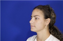 Rhinoplasty After Photo by Thanapoom Boonipat, MD; Lubbock, TX - Case 51592