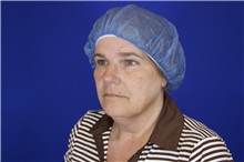 Facelift Before Photo by Thanapoom Boonipat, MD; Lubbock, TX - Case 51594