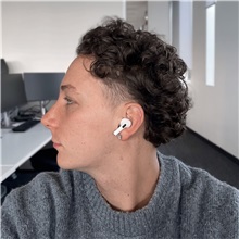 Rhinoplasty After Photo by Celal Alioglu, MD; Istanbul, M - Case 51039