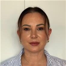 Facelift After Photo by Cem Berkay SINACI, MD; Istanbul, M - Case 50988
