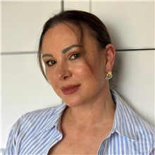 Facelift After Photo by Cem Berkay SINACI, MD; Istanbul, M - Case 50988