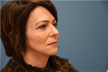 Facelift After Photo by Derek Cody, MD, FACS; ,  - Case 50718