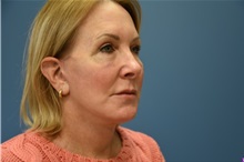 Facelift After Photo by Derek Cody, MD, FACS; ,  - Case 50791