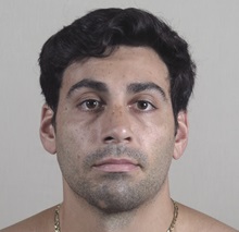 Rhinoplasty After Photo by Paul Parker, MD; Paramus, NJ - Case 49984