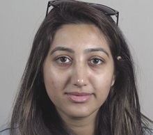 Rhinoplasty After Photo by Paul Parker, MD; Paramus, NJ - Case 49983