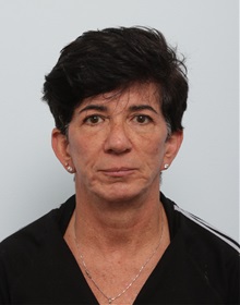 Facelift Before Photo by Paul Vitenas, Jr., MD; Houston, TX - Case 50027