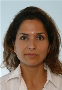 Rhinoplasty Before Photo by Paul Vitenas, Jr., MD; Houston, TX - Case 50095