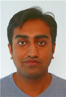 Rhinoplasty Before Photo by Paul Vitenas, Jr., MD; Houston, TX - Case 50107