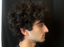 Rhinoplasty Before Photo by M. Zakir Sabry, MD; New York, NY - Case 51399