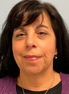 Facelift After Photo by Julia Spears, MD, FACS; ,  - Case 50697