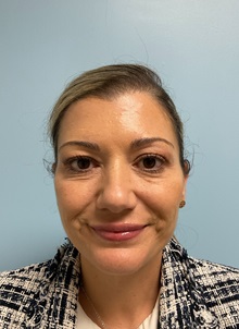 Botulinum Toxin After Photo by Julia Spears, MD, FACS; Marlton, NJ - Case 49842 Botulinum Toxin After Photo by Julia Spears, MD, FACS; Marlton, NJ - Case 49842