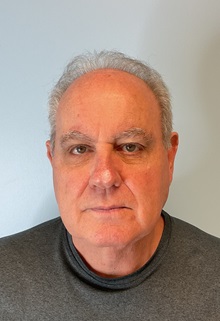 Facelift After Photo by Julia Spears, MD, FACS; Marlton, NJ - Case 49993 Facelift After Photo by Julia Spears, MD, FACS; Marlton, NJ - Case 49993