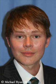 Facelift After Photo by Michael Byun, MD; Chicago, IL - Case 24334