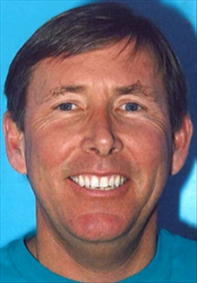 Liposuction Before Photo by Daniel Mills, MD; ,  - Case 24609