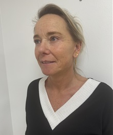 Facelift After Photo by Gudjon Gunnarsson, MD; Skien,  - Case 50639