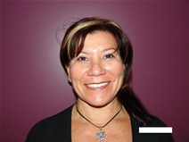 Facelift After Photo by Moneer Jaibaji, MD; Coronado, CA - Case 20658