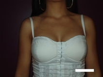 Breast Augmentation Before Photo by Moneer Jaibaji, MD; Coronado, CA - Case 22594
