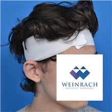 Ear Surgery Before Photo by Jonathan Weinrach, MD; ,  - Case 36836