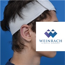 Ear Surgery After Photo by Jonathan Weinrach, MD; ,  - Case 36836