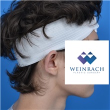 Ear Surgery Before Photo by Jonathan Weinrach, MD; ,  - Case 36836