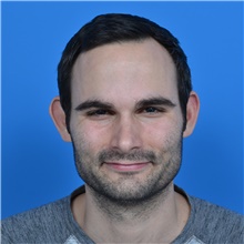 Ear Surgery Before Photo by Jonathan Weinrach, MD; Scottsdale, AZ - Case 38847